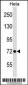 LAS1L Antibody (C-term)